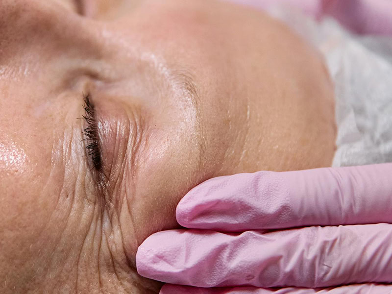 ICONIQUE Revolutionary Beauty Erfahrungen: Schweizer Exzellenz in der Hautpflege